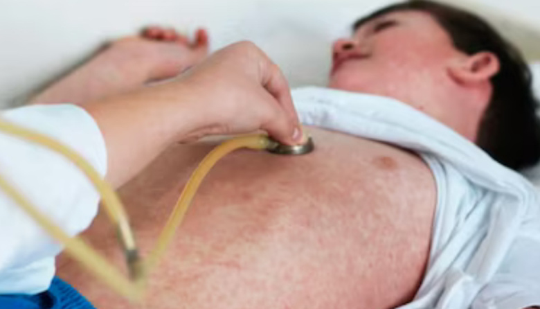 Reportan un caso de sarampión en Entre Ríos y se reactiva la alerta sanitaria nacional