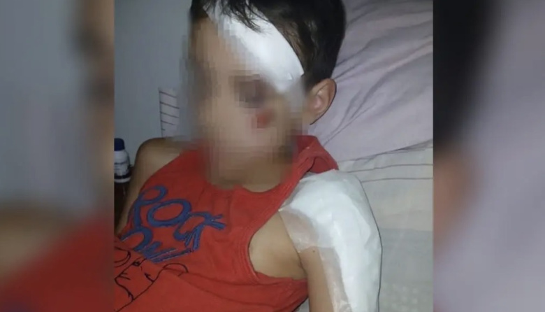 Se entregó el conductor que atropelló a un niño y se fugó en Crespo