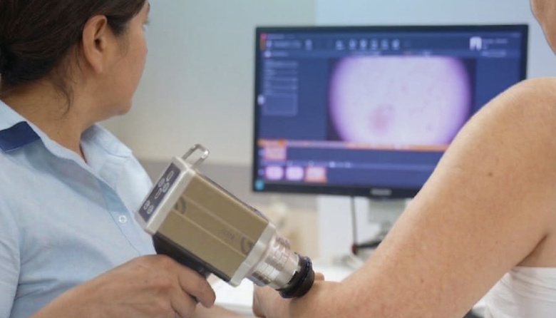 El Sanatorio Adventista del Plata incorpora dermatoscopía digital para la detección temprana de lesiones cutáneas