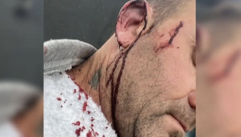Intendente entrerriano resultó herido tras una pelea con un concejal