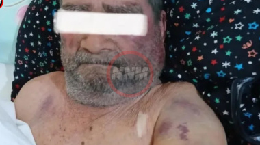 Agresión en Viale: descartan robo y apuntan a un conflicto personal como causa