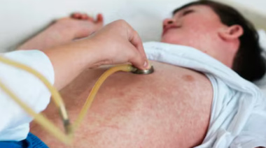 Reportan un caso de sarampión en Entre Ríos y se reactiva la alerta sanitaria nacional