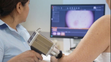 El Sanatorio Adventista del Plata incorpora dermatoscopía digital para la detección temprana de lesiones cutáneas