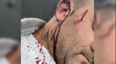 Intendente entrerriano resultó herido tras una pelea con un concejal