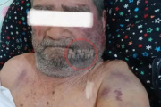 Agresión en Viale: descartan robo y apuntan a un conflicto personal como causa