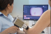 El Sanatorio Adventista del Plata incorpora dermatoscopía digital para la detección temprana de lesiones cutáneas