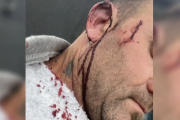 Intendente entrerriano resultó herido tras una pelea con un concejal